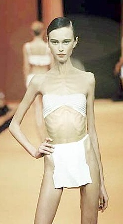 Anorexic-model.jpg